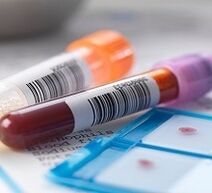 Diagnosis of prostatitis lab