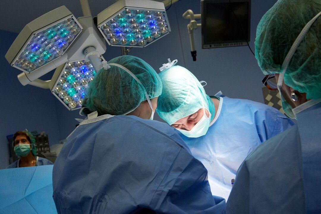 Operation in chronic prostatitis